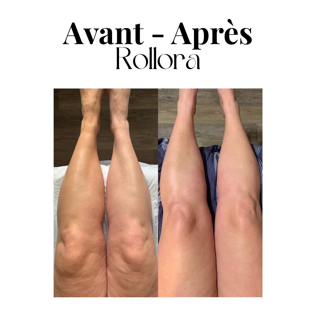 Rouleau de massage