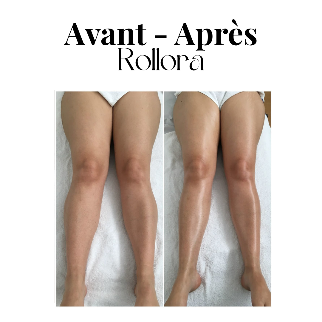 Rouleau de massage