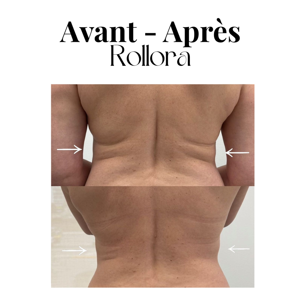 Rouleau de massage