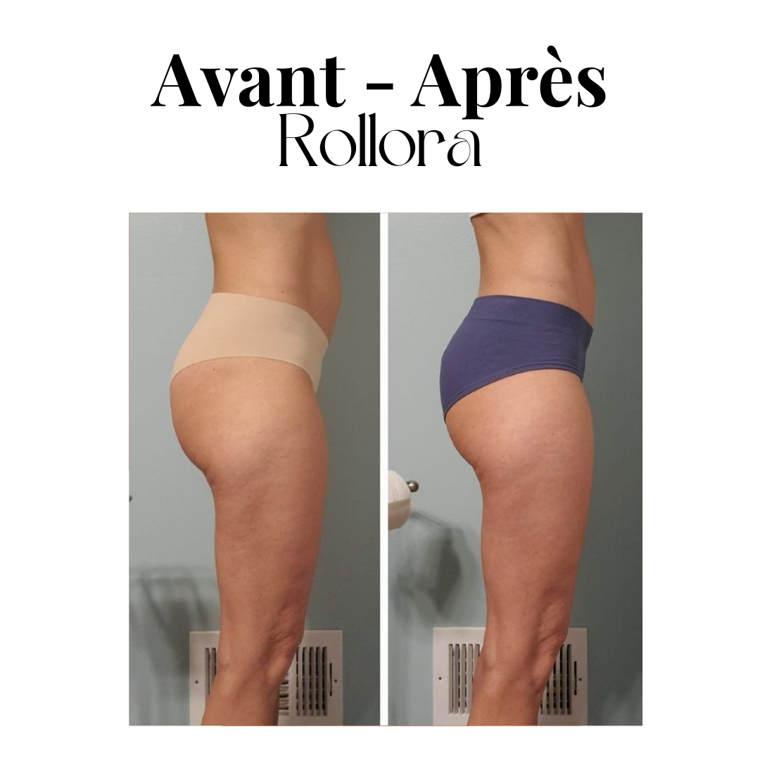 Rouleau de massage