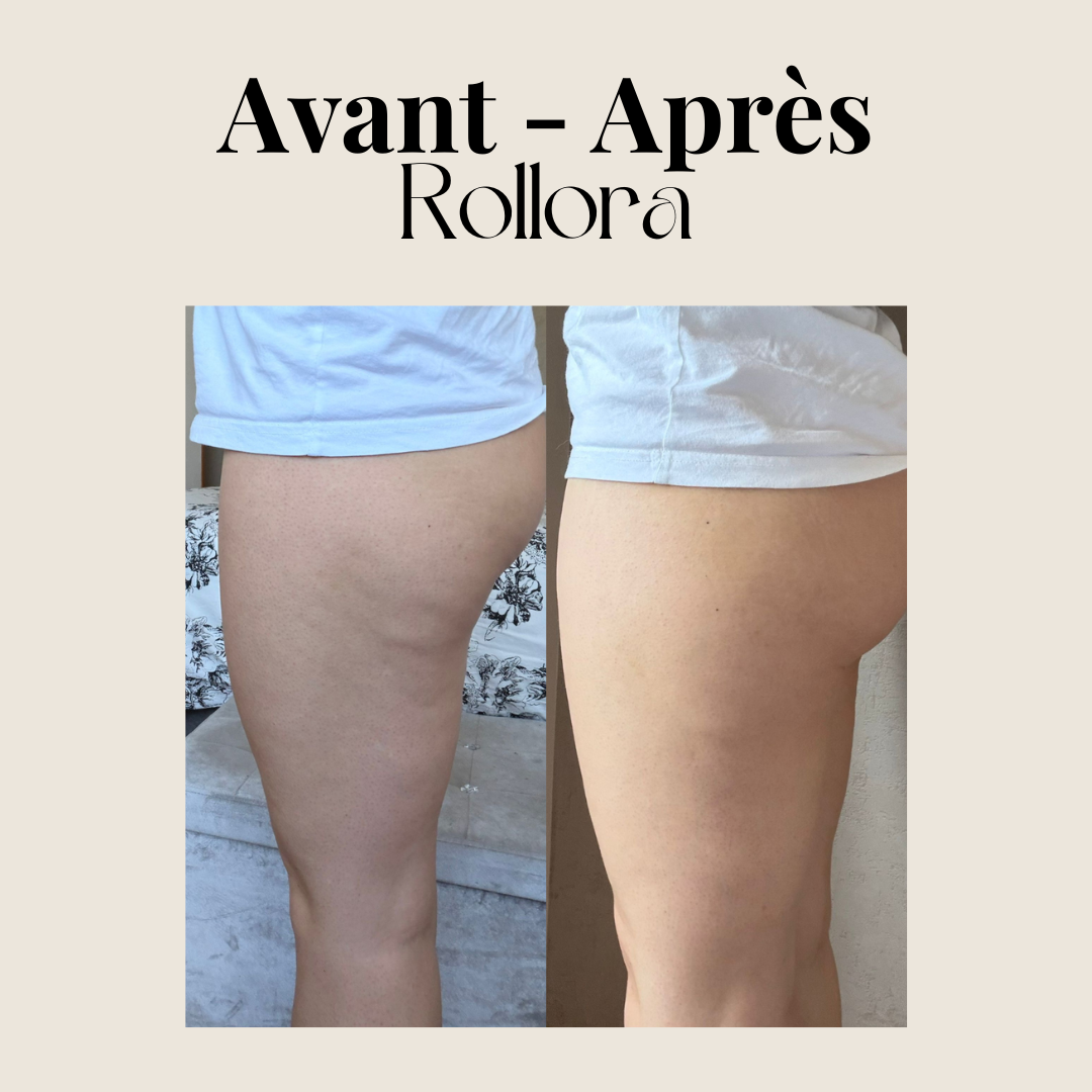 Rouleau de massage