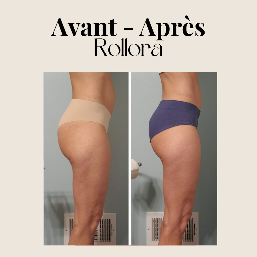 Rouleau de massage