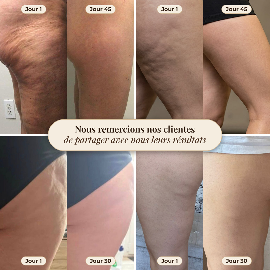 Rouleau de massage